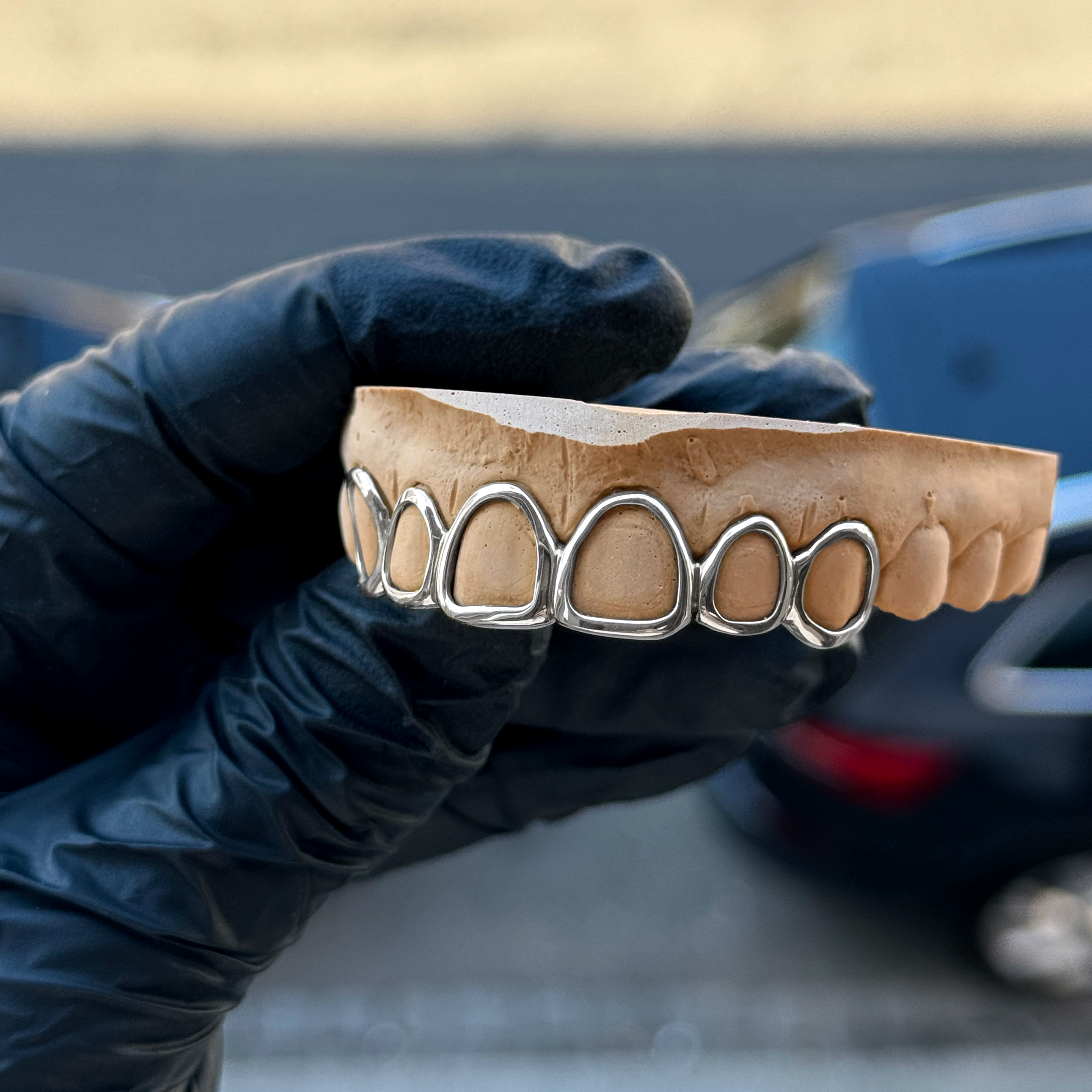 Grillz Demi-Dentition