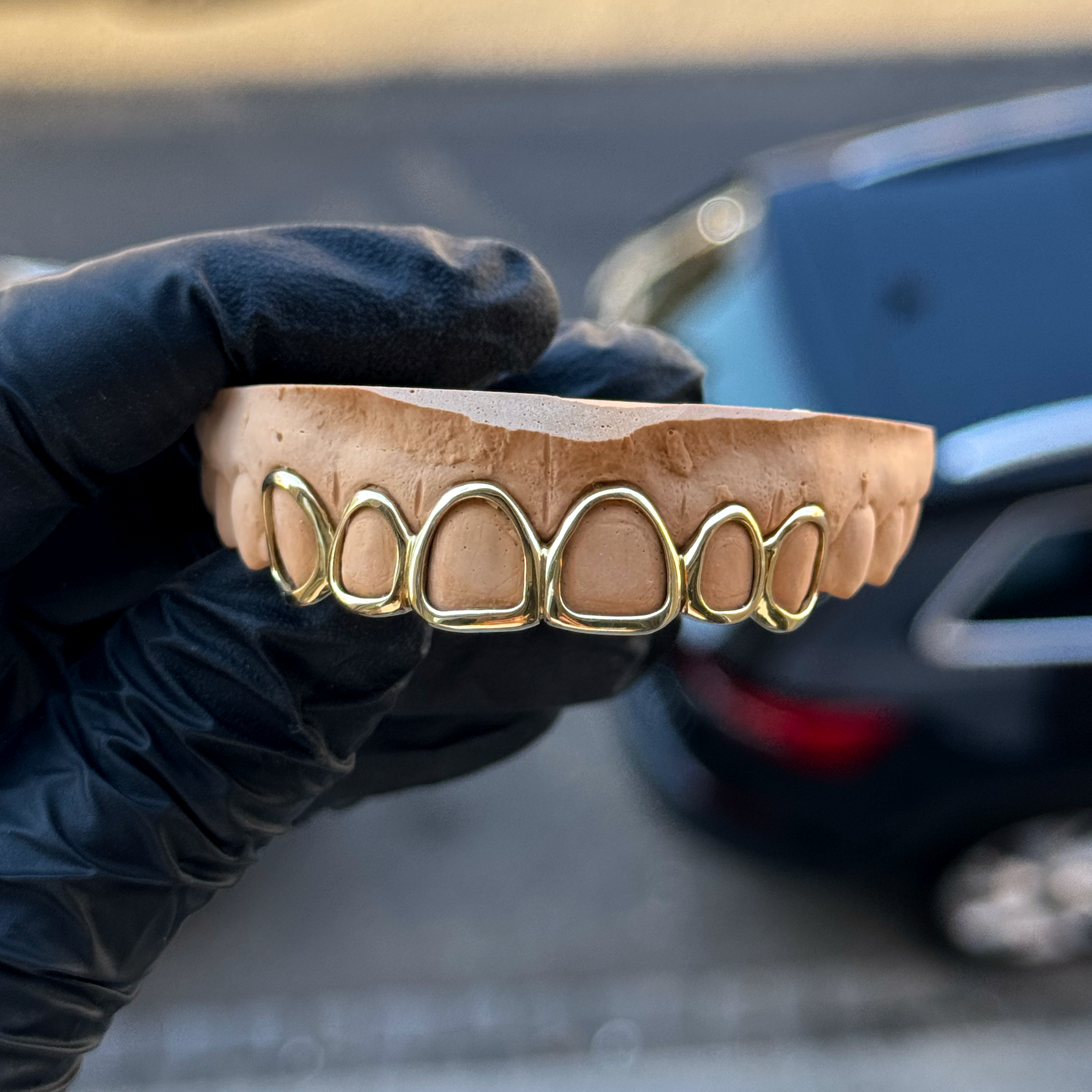 Grillz Demi-Dentition