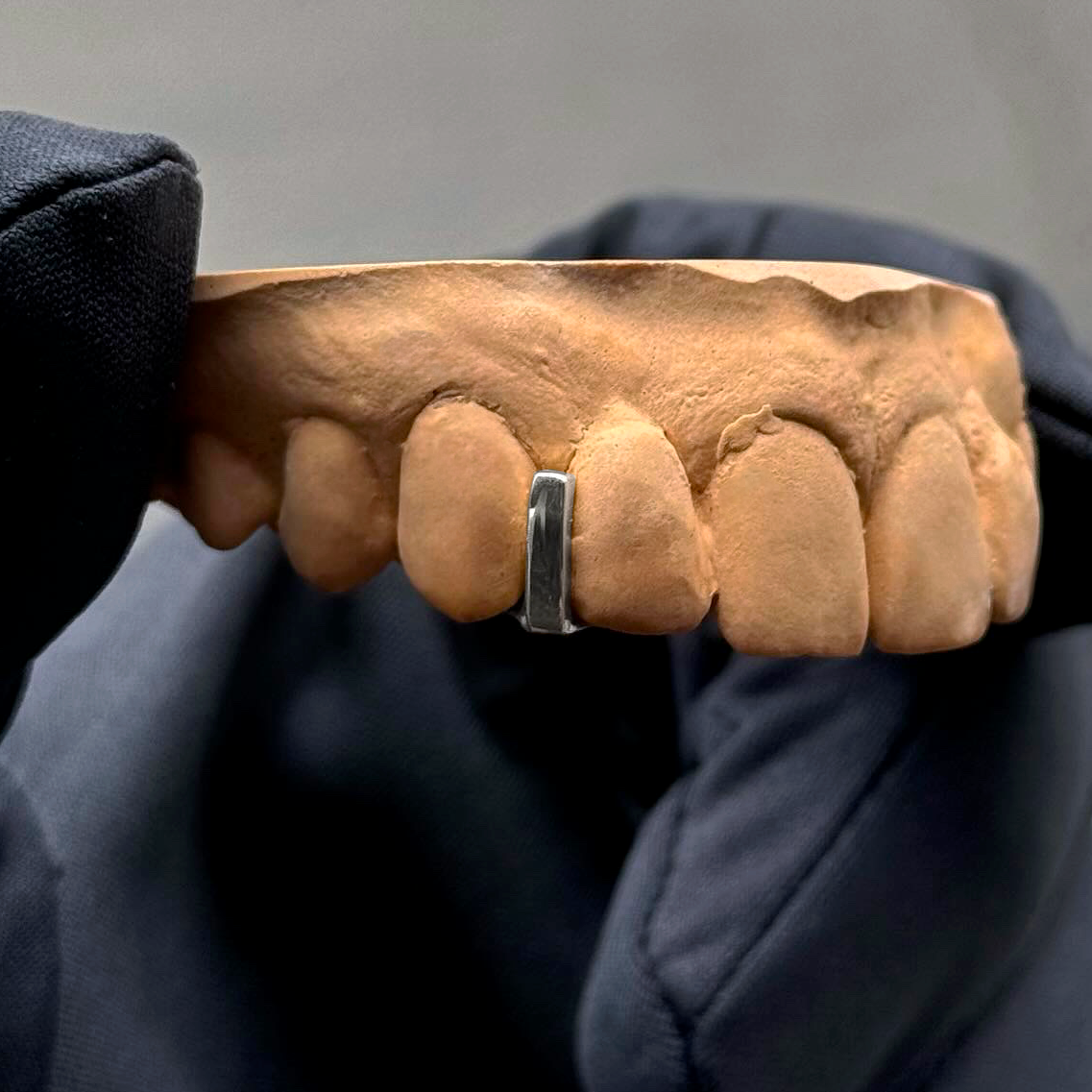 Grillz Interstice