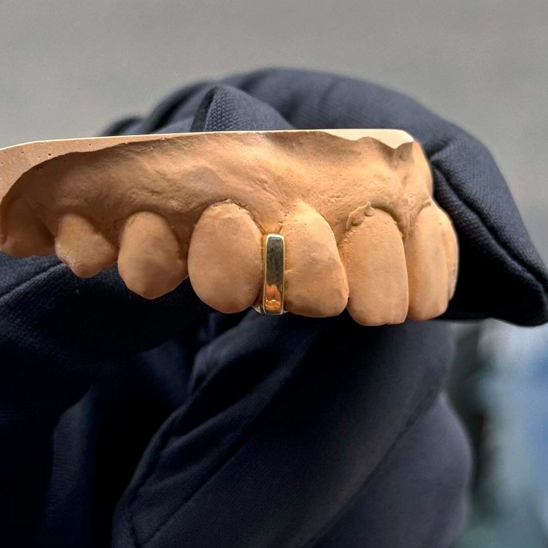 Grillz Interstice
