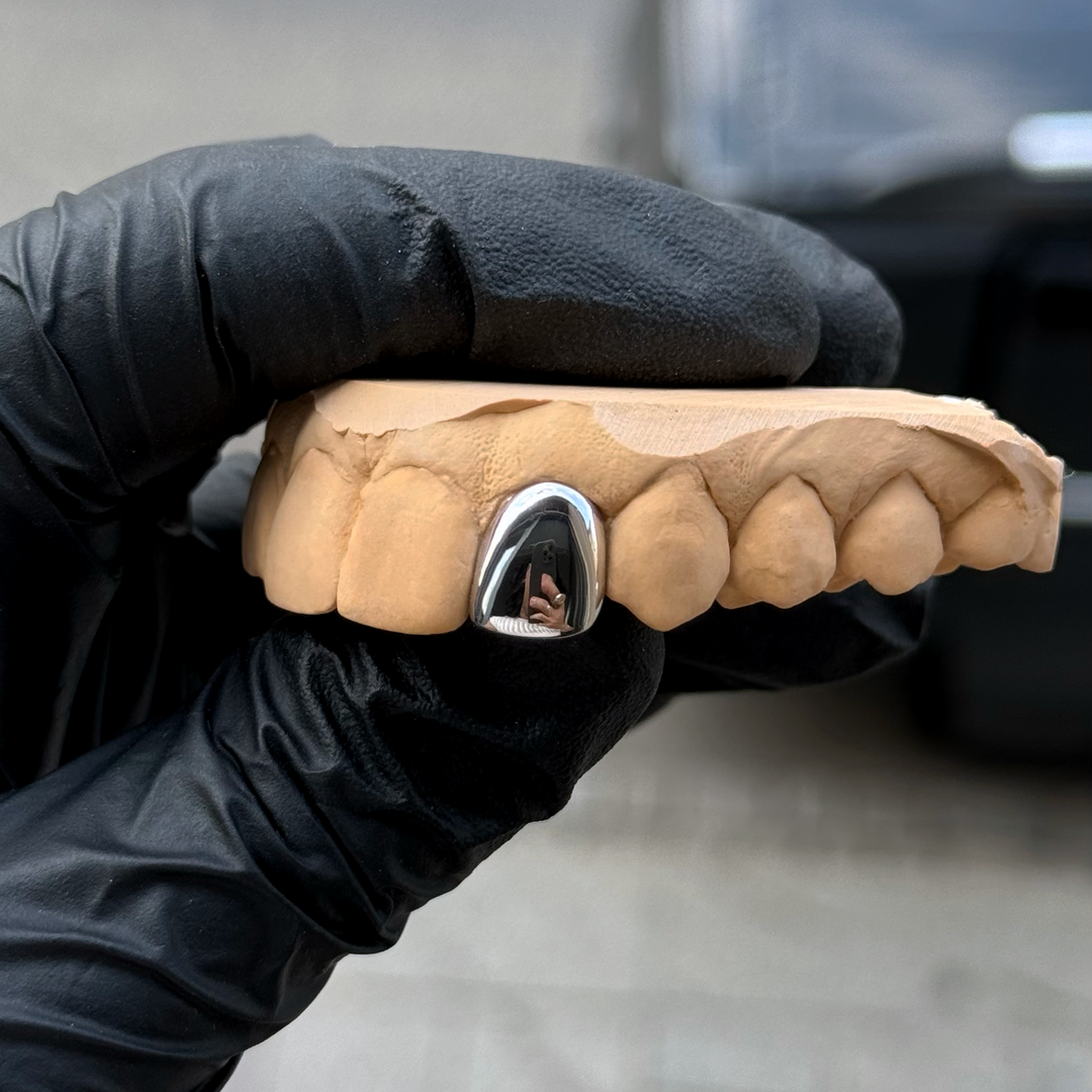 Ensemble De Grillz En Or Glacé Plaqué Or 18 Carats, Dents De